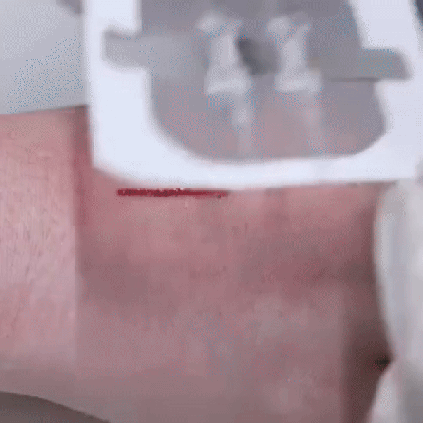 PainEase™ Wound Closure Kit