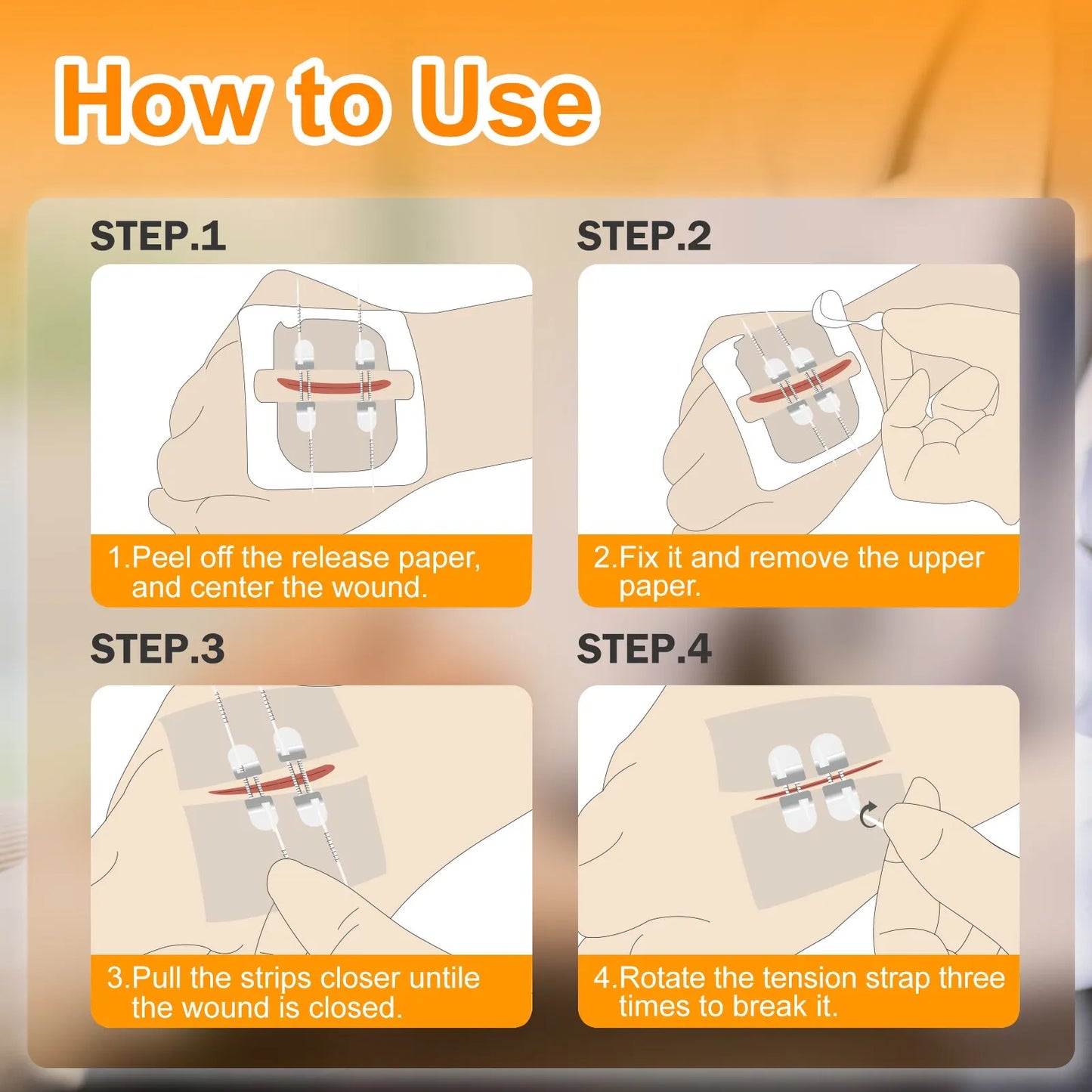 PainEase™ Wound Closure Kit