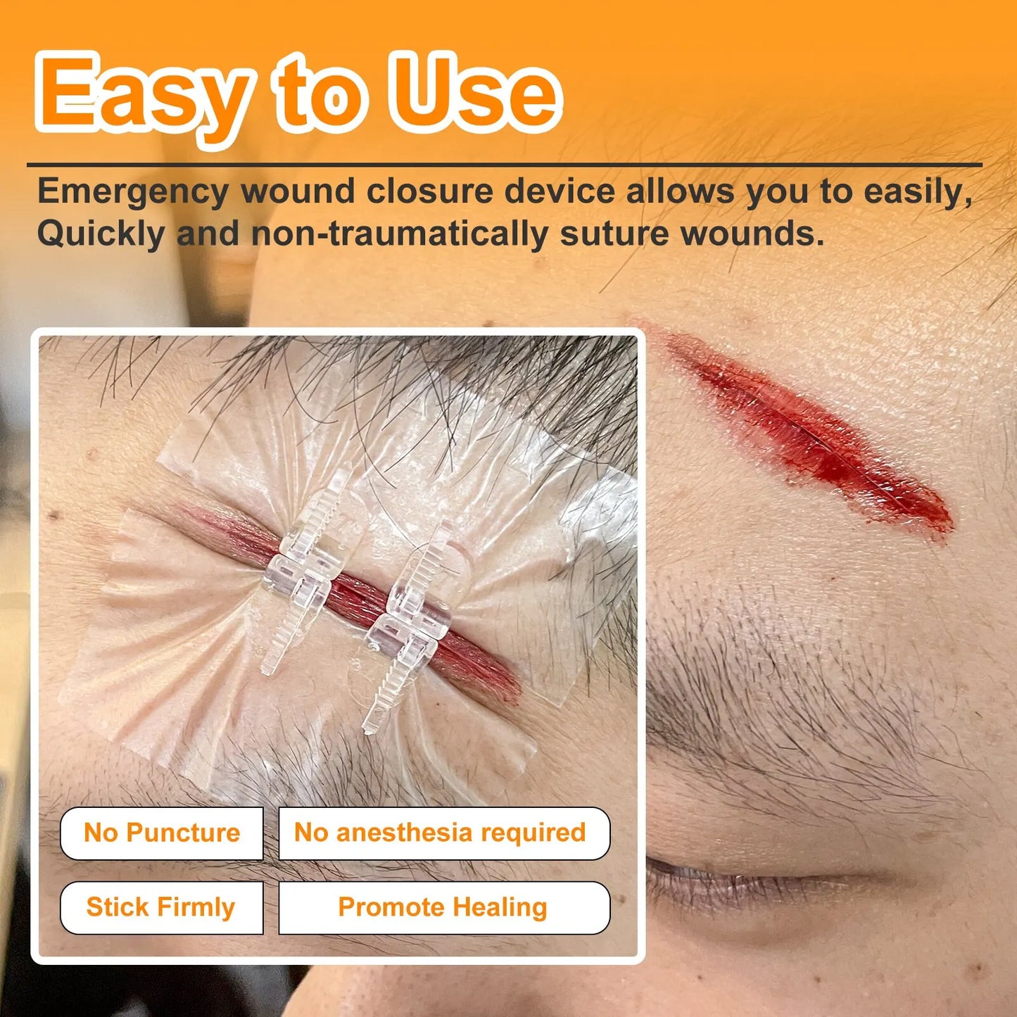PainEase™ Wound Closure Kit