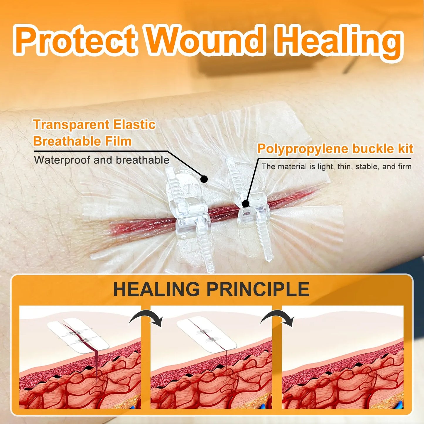 PainEase™ Wound Closure Kit