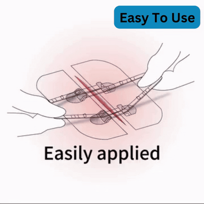 PainEase™  Wound Closure Kit